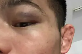 全国武术散打季军称遭多名运动员群殴霸凌，患上抑郁症，未得批假治病反被停训退役，病情加重图片