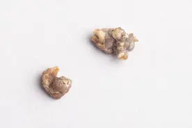 医生提醒与南瓜相克的6大食物，建议两者不要一起食用，别不听劝图片