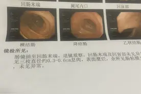 肠胃镜检查之后，医生要求住院做手术，肚都气炸了。图片