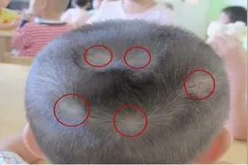 孩子头顶“几个旋”到底意味着什么？不少父母不懂，建议都看看图片