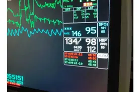 从确诊到死20天，《我妻之死》中的妻子小敏，是被丈夫吸光了血图片