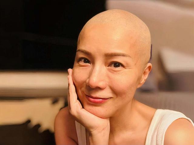 香港知名女星乳腺癌复发，头发掉光裹头巾出镜，做按摩发现病情