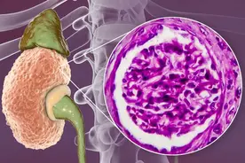放屁多，是肠道在求救？还是健康在自证？你可能一直都误会了图片
