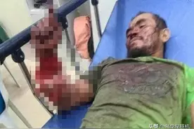 菲律宾男子被巨蟒缠身，在最危急的时刻，他选择了“反咬”求生！图片