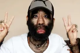 “毛孩”于震寰：46年前因一身黑毛轰动全国，如今他怎么样了？图片