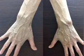 手臂“青筋暴起”的人，和几乎看不到青筋的人对比，哪个更健康？图片