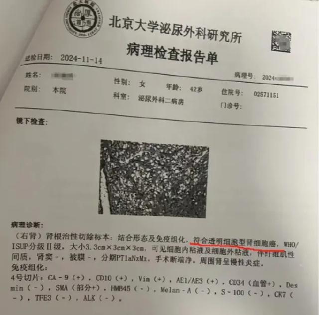 张晓玲律师回应爱康国宾起诉