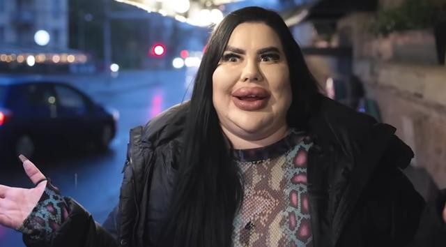 为打造全球最大臀部，她常年做高风险手术，从美女整成了半人马?