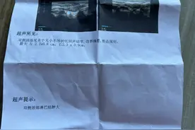 婴幼儿颈部淋巴结肿大之经验分享图片