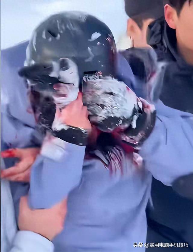 雪豹咬人内幕曝出！村支书还原真相	，央视发文怒批，当事人被打脸