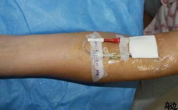 宿舍里的护工姐妹，为了海王大打出手|擦拭夕阳（中）