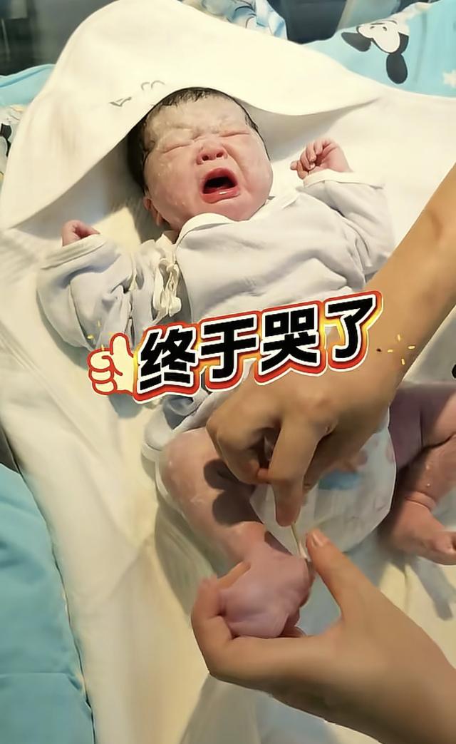 “最惨新生儿”火了，因为太淡定被医生轮番“暴揍”，说好看才哭
