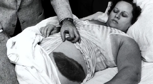 “尼帕病毒	”来势汹汹，呼吁：每家备好5样东西	，关键时刻能救命