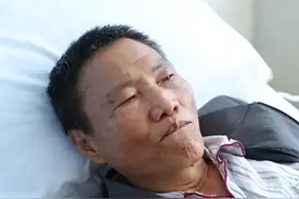 一家3口长期吃自榨油，集体肝功能受损！警惕：这4类油也别多吃图片