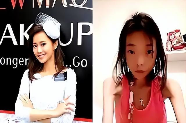 一代女神沦为豪门玩物？结婚8年牙齿全掉，器官切除，面似骷髅
