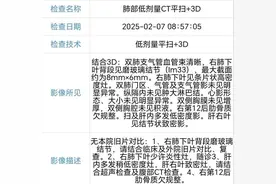 8mm磨玻璃结节多种结论该如何?精准诊断可随访可手术并给手术方案图片