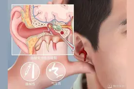 颅内感染！脑脊液流淌不止！一岁半娃掏耳屎致鼓膜穿孔图片