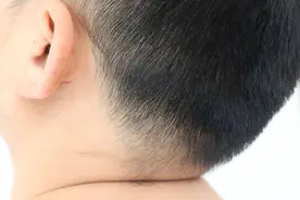 头上白头发多？建议平时多吃这3类食物，黑芝麻未上榜图片
