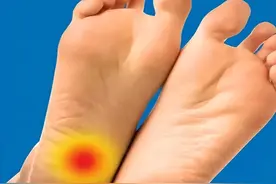 体内有病，足底先知？若有这3种症状出现，可能是疾病在“预警”图片