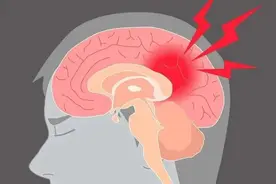 总犯困？小心是脑梗，记住这个口诀，关键时候能救命！图片