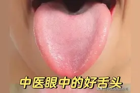 舌苔，是孩子身体健康真实的镜子，这7种情况教你对症调图片