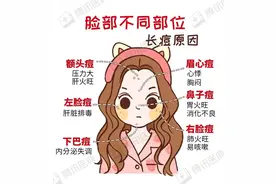 脸上长痘暗示身体出了问题？真相有点扎心…图片