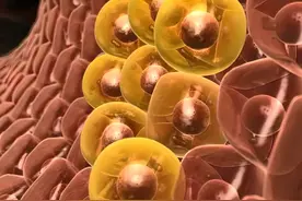 夫妻二人同时确诊！山西省中医院提醒：这3种癌容易成为“夫妻癌”，需要引起重视！图片