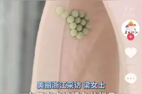 头皮发麻，女子被吓到尖叫！最近又到高峰期，很多人衣服上都有…...图片