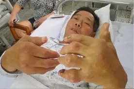 痛风，人就等于废一半？痛风患者，身体有3变化，或是发作的苗头图片