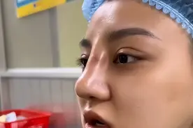 这种假体鼻修复率登顶，多数人毫不知情，马上转发给想整形的亲友图片