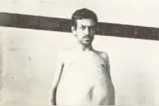 美国男子便秘而亡，医生在其体内发现2.4米长，整整36斤粪便图片