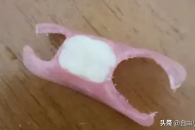 拔牙后装假牙的过程!图片