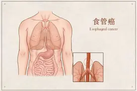 喝酒脸红的快戒酒！专家表示患这种癌几率很高图片