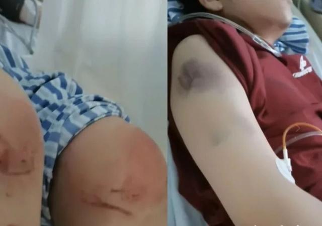 河北女子遭家暴驾车逃跑致丈夫死亡案开庭，女子父亲谈案发细节：她被扒光衣服遭持刀威胁	，逃命还能逃出罪来