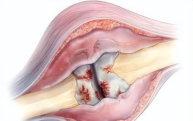 长期跑步有利于健康吗？医生：过了60岁的老人，建议做好5件事
