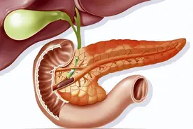 什么原因引起的胰腺炎？日常饮食注意这几点，远离胰腺炎图片