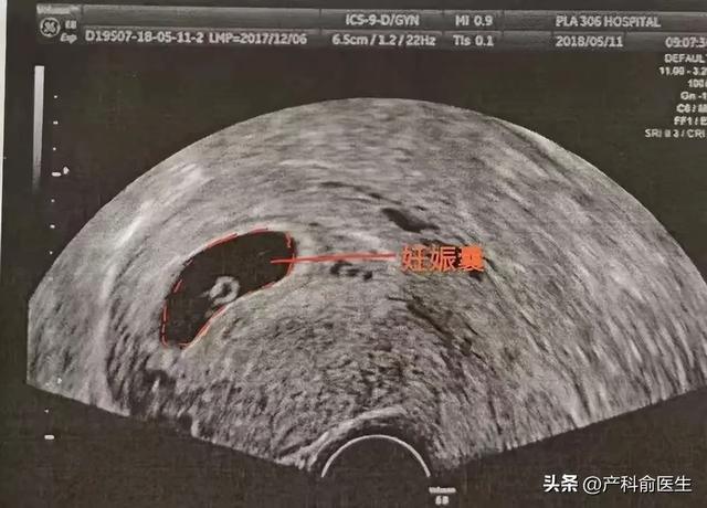 产科医生