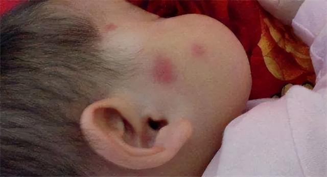 床上"螨虫成堆"?教你一个土法子，家里放些它，螨虫“都跑光了”