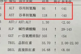 “谷草转氨酶”与“谷丙转氨酶”，哪个升高更危险？怎样降下来？图片