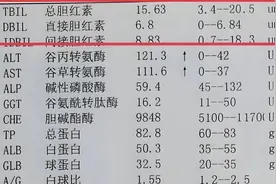 乙肝患者，不出现这4种情况，恭喜你病情相对稳定图片