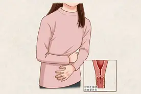 经期血颜色发黑、有血块，是身体“排毒”？听听妇科专家怎么说图片