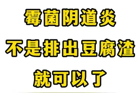 通过阴道冲洗或治疗后分泌物排出，是霉菌已经被消灭了吗？图片