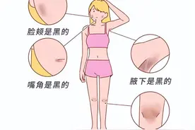 女性身体的这些部位，为啥总是黑黑的？图片
