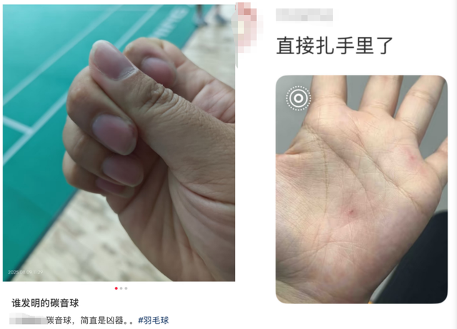 “杀伤力”如此惊人！上海人都喜欢的这项运动，已致多人受伤！插入眉骨、扎穿手指，凶器竟是