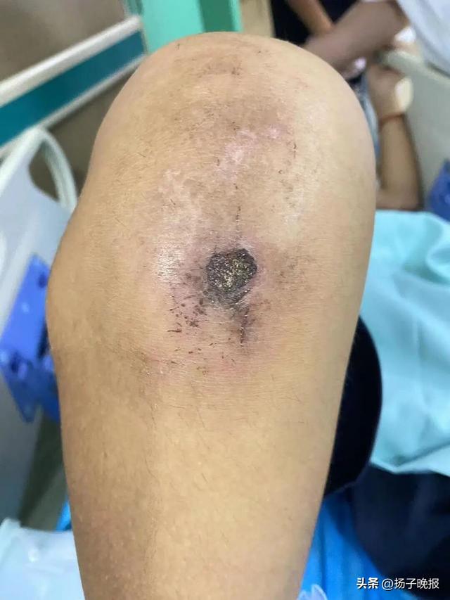 “跪举水盆、扇耳光、关小黑屋”，男孩被虐待28天致重伤二级，校长和3名教官被刑拘，4人涉嫌虐待罪被起诉