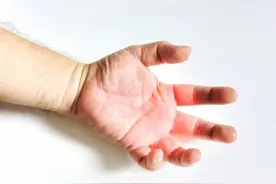 如何判断肢体麻木是否为疾病症状？图片