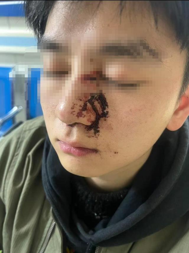 女子遛狗不牵绳，男子质问反被打成轻伤	，二审判了 伤者：还将提起民事诉讼索赔