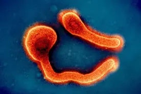 比埃博拉还“毒”！这种致命病毒让德国如临大敌图片