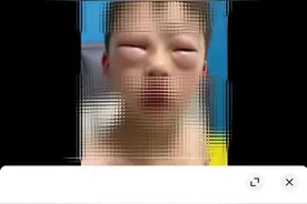 “小孩哥”一写作业眼睛就肿成 “奥特曼”？原因找到了，他有这个习惯图片