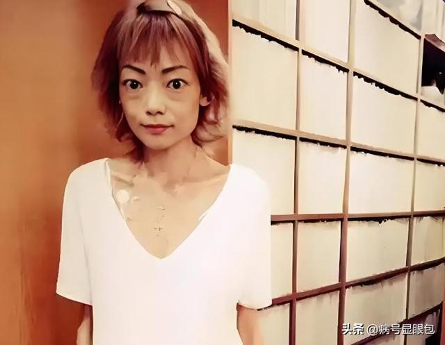 一代女神沦为豪门玩物？结婚8年牙齿全掉，器官切除，面似骷髅